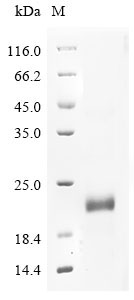 (Tris-Glycine gel) Discontinuous SDS-PAGE (reduced) with 5% enrichment gel and 15% separation gel. (Tris-Glycine gel) Discontinuous SDS-PAGE (reduced) with 5% enrichment gel and 15% separation gel.