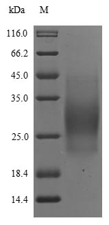 Recombinant Human Interleukin-5 (IL5) - image 1