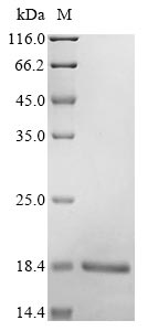 (Tris-Glycine gel) Discontinuous SDS-PAGE (reduced) with 5% enrichment gel and 15% separation gel. (Tris-Glycine gel) Discontinuous SDS-PAGE (reduced) with 5% enrichment gel and 15% separation gel.