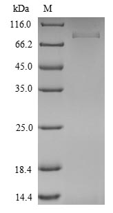 (Tris-Glycine gel) Discontinuous SDS-PAGE (reduced) with 5% enrichment gel and 15% separation gel. (Tris-Glycine gel) Discontinuous SDS-PAGE (reduced) with 5% enrichment gel and 15% separation gel.