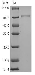 (Tris-Glycine gel) Discontinuous SDS-PAGE (reduced) with 5% enrichment gel and 15% separation gel. (Tris-Glycine gel) Discontinuous SDS-PAGE (reduced) with 5% enrichment gel and 15% separation gel.