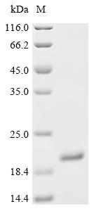 Recombinant Human Lipocalin-1 (LCN1) - image 1