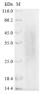 Recombinant Human L-lactate dehydrogenase A chain (LDHA) - image 1