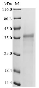 (Tris-Glycine gel) Discontinuous SDS-PAGE (reduced) with 5% enrichment gel and 15% separation gel. (Tris-Glycine gel) Discontinuous SDS-PAGE (reduced) with 5% enrichment gel and 15% separation gel.