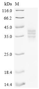 Recombinant Mouse Lymphocyte antigen 6D (Ly6d) - image 1