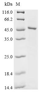 Recombinant Human S-adenosylmethionine synthase isoform type-1 (MAT1A) - image 1