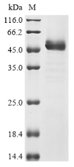 (Tris-Glycine gel) Discontinuous SDS-PAGE (reduced) with 5% enrichment gel and 15% separation gel. (Tris-Glycine gel) Discontinuous SDS-PAGE (reduced) with 5% enrichment gel and 15% separation gel.