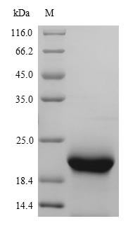 (Tris-Glycine gel) Discontinuous SDS-PAGE (reduced) with 5% enrichment gel and 15% separation gel. (Tris-Glycine gel) Discontinuous SDS-PAGE (reduced) with 5% enrichment gel and 15% separation gel.