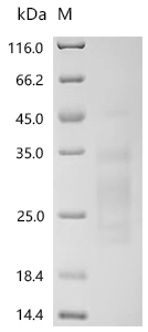 Recombinant Human Mannose-binding protein C (MBL2) - image 1