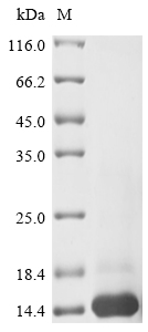 (Tris-Glycine gel) Discontinuous SDS-PAGE (reduced) with 5% enrichment gel and 15% separation gel. (Tris-Glycine gel) Discontinuous SDS-PAGE (reduced) with 5% enrichment gel and 15% separation gel.