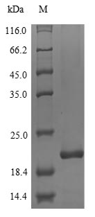 (Tris-Glycine gel) Discontinuous SDS-PAGE (reduced) with 5% enrichment gel and 15% separation gel. (Tris-Glycine gel) Discontinuous SDS-PAGE (reduced) with 5% enrichment gel and 15% separation gel.