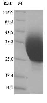 (Tris-Glycine gel) Discontinuous SDS-PAGE (reduced) with 5% enrichment gel and 15% separation gel. (Tris-Glycine gel) Discontinuous SDS-PAGE (reduced) with 5% enrichment gel and 15% separation gel.