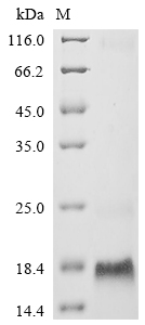 (Tris-Glycine gel) Discontinuous SDS-PAGE (reduced) with 5% enrichment gel and 15% separation gel. (Tris-Glycine gel) Discontinuous SDS-PAGE (reduced) with 5% enrichment gel and 15% separation gel.