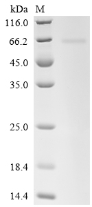 Recombinant Human N-myc proto-oncogene protein (MYCN) - image 1
