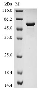 (Tris-Glycine gel) Discontinuous SDS-PAGE (reduced) with 5% enrichment gel and 15% separation gel. (Tris-Glycine gel) Discontinuous SDS-PAGE (reduced) with 5% enrichment gel and 15% separation gel.