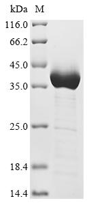 (Tris-Glycine gel) Discontinuous SDS-PAGE (reduced) with 5% enrichment gel and 15% separation gel. (Tris-Glycine gel) Discontinuous SDS-PAGE (reduced) with 5% enrichment gel and 15% separation gel.