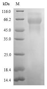 (Tris-Glycine gel) Discontinuous SDS-PAGE (reduced) with 5% enrichment gel and 15% separation gel. (Tris-Glycine gel) Discontinuous SDS-PAGE (reduced) with 5% enrichment gel and 15% separation gel.