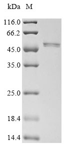 (Tris-Glycine gel) Discontinuous SDS-PAGE (reduced) with 5% enrichment gel and 15% separation gel. (Tris-Glycine gel) Discontinuous SDS-PAGE (reduced) with 5% enrichment gel and 15% separation gel.