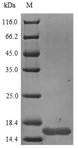 (Tris-Glycine gel) Discontinuous SDS-PAGE (reduced) with 5% enrichment gel and 15% separation gel. (Tris-Glycine gel) Discontinuous SDS-PAGE (reduced) with 5% enrichment gel and 15% separation gel.