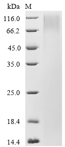 (Tris-Glycine gel) Discontinuous SDS-PAGE (reduced) with 5% enrichment gel and 15% separation gel. (Tris-Glycine gel) Discontinuous SDS-PAGE (reduced) with 5% enrichment gel and 15% separation gel.