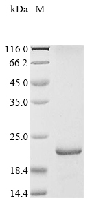(Tris-Glycine gel) Discontinuous SDS-PAGE (reduced) with 5% enrichment gel and 15% separation gel. (Tris-Glycine gel) Discontinuous SDS-PAGE (reduced) with 5% enrichment gel and 15% separation gel.