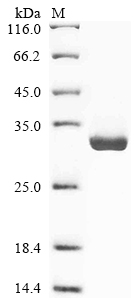 (Tris-Glycine gel) Discontinuous SDS-PAGE (reduced) with 5% enrichment gel and 15% separation gel. (Tris-Glycine gel) Discontinuous SDS-PAGE (reduced) with 5% enrichment gel and 15% separation gel.