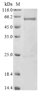 (Tris-Glycine gel) Discontinuous SDS-PAGE (reduced) with 5% enrichment gel and 15% separation gel. (Tris-Glycine gel) Discontinuous SDS-PAGE (reduced) with 5% enrichment gel and 15% separation gel.