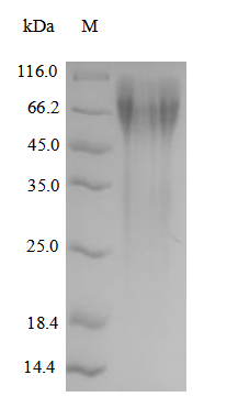 SDS-PAGE- Recombinant protein Human NR4A2