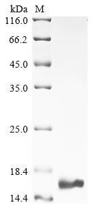 (Tris-Glycine gel) Discontinuous SDS-PAGE (reduced) with 5% enrichment gel and 15% separation gel. (Tris-Glycine gel) Discontinuous SDS-PAGE (reduced) with 5% enrichment gel and 15% separation gel.