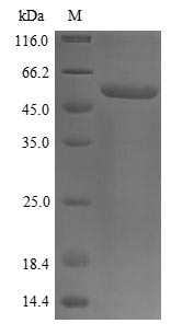(Tris-Glycine gel) Discontinuous SDS-PAGE (reduced) with 5% enrichment gel and 15% separation gel. (Tris-Glycine gel) Discontinuous SDS-PAGE (reduced) with 5% enrichment gel and 15% separation gel.