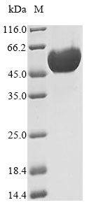 (Tris-Glycine gel) Discontinuous SDS-PAGE (reduced) with 5% enrichment gel and 15% separation gel. (Tris-Glycine gel) Discontinuous SDS-PAGE (reduced) with 5% enrichment gel and 15% separation gel.