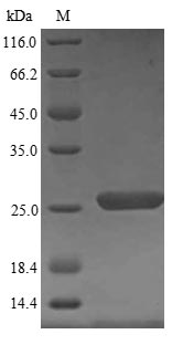 (Tris-Glycine gel) Discontinuous SDS-PAGE (reduced) with 5% enrichment gel and 15% separation gel. (Tris-Glycine gel) Discontinuous SDS-PAGE (reduced) with 5% enrichment gel and 15% separation gel.