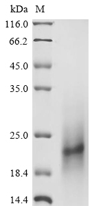 (Tris-Glycine gel) Discontinuous SDS-PAGE (reduced) with 5% enrichment gel and 15% separation gel. (Tris-Glycine gel) Discontinuous SDS-PAGE (reduced) with 5% enrichment gel and 15% separation gel.