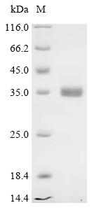 Recombinant Chicken Peptide YY-like (PYY) - image 1