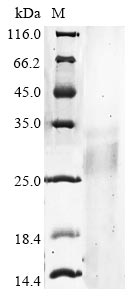 (Tris-Glycine gel) Discontinuous SDS-PAGE (reduced) with 5% enrichment gel and 15% separation gel. (Tris-Glycine gel) Discontinuous SDS-PAGE (reduced) with 5% enrichment gel and 15% separation gel.