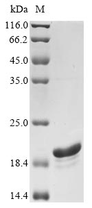 (Tris-Glycine gel) Discontinuous SDS-PAGE (reduced) with 5% enrichment gel and 15% separation gel. (Tris-Glycine gel) Discontinuous SDS-PAGE (reduced) with 5% enrichment gel and 15% separation gel.