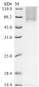 Recombinant Human Serpin B10 (SERPINB10) - image 1
