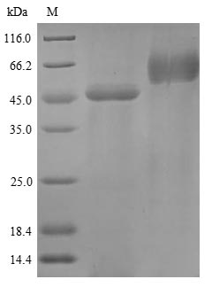 (Tris-Glycine gel) Discontinuous SDS-PAGE (reduced) with 5% enrichment gel and 15% separation gel. (Tris-Glycine gel) Discontinuous SDS-PAGE (reduced) with 5% enrichment gel and 15% separation gel.