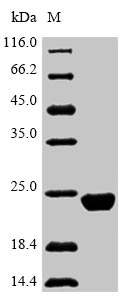 (Tris-Glycine gel) Discontinuous SDS-PAGE (reduced) with 5% enrichment gel and 15% separation gel. (Tris-Glycine gel) Discontinuous SDS-PAGE (reduced) with 5% enrichment gel and 15% separation gel.