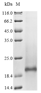 (Tris-Glycine gel) Discontinuous SDS-PAGE (reduced) with 5% enrichment gel and 15% separation gel. (Tris-Glycine gel) Discontinuous SDS-PAGE (reduced) with 5% enrichment gel and 15% separation gel.