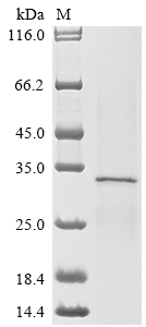 (Tris-Glycine gel) Discontinuous SDS-PAGE (reduced) with 5% enrichment gel and 15% separation gel. (Tris-Glycine gel) Discontinuous SDS-PAGE (reduced) with 5% enrichment gel and 15% separation gel.