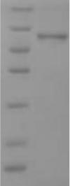 SDS-PAGE- Recombinant protein Human SPRR2B