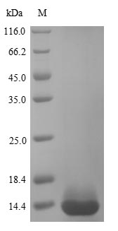 (Tris-Glycine gel) Discontinuous SDS-PAGE (reduced) with 5% enrichment gel and 15% separation gel. (Tris-Glycine gel) Discontinuous SDS-PAGE (reduced) with 5% enrichment gel and 15% separation gel.