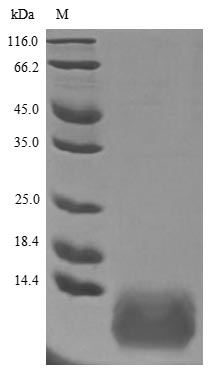 (Tris-Glycine gel) Discontinuous SDS-PAGE (reduced) with 5% enrichment gel and 15% separation gel. (Tris-Glycine gel) Discontinuous SDS-PAGE (reduced) with 5% enrichment gel and 15% separation gel.