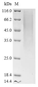 Recombinant Mouse Transmembrane protein 106B (Tmem106b) , partial - image 1