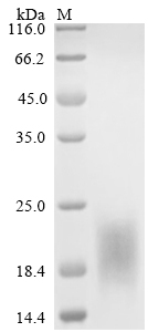 (Tris-Glycine gel) Discontinuous SDS-PAGE (reduced) with 5% enrichment gel and 15% separation gel. (Tris-Glycine gel) Discontinuous SDS-PAGE (reduced) with 5% enrichment gel and 15% separation gel.