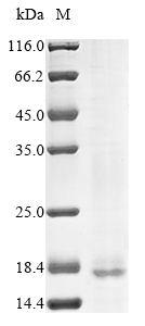 Recombinant Human Cell surface hyaluronidase (TMEM2) , partial - image 1