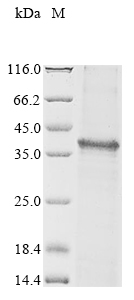 (Tris-Glycine gel) Discontinuous SDS-PAGE (reduced) with 5% enrichment gel and 15% separation gel. (Tris-Glycine gel) Discontinuous SDS-PAGE (reduced) with 5% enrichment gel and 15% separation gel.