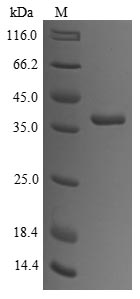 (Tris-Glycine gel) Discontinuous SDS-PAGE (reduced) with 5% enrichment gel and 15% separation gel. (Tris-Glycine gel) Discontinuous SDS-PAGE (reduced) with 5% enrichment gel and 15% separation gel.