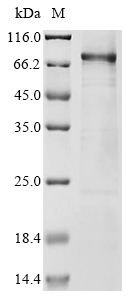 (Tris-Glycine gel) Discontinuous SDS-PAGE (reduced) with 5% enrichment gel and 15% separation gel. (Tris-Glycine gel) Discontinuous SDS-PAGE (reduced) with 5% enrichment gel and 15% separation gel.
